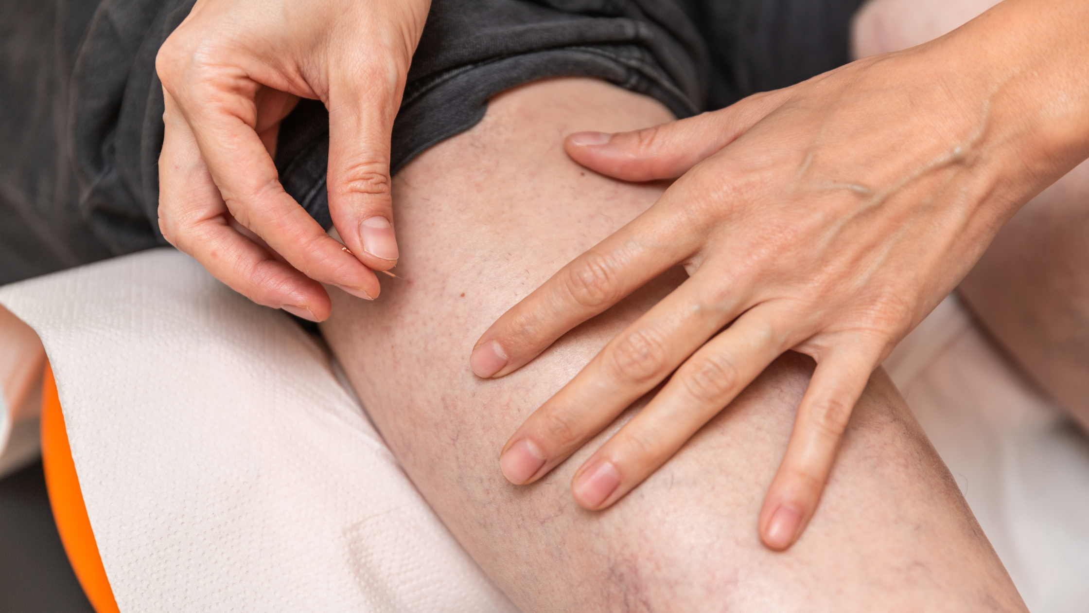How does dry needling work?